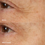 SMART CLINICAL REPAIR OVERNIGHT RECOVERY CREAM + MASK